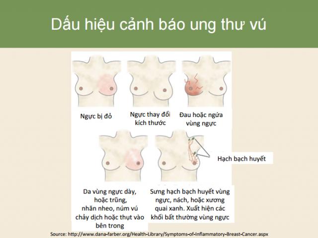 11 gợi ý phòng chống ung thư của TS Việt được vinh danh tại Mỹ - 5