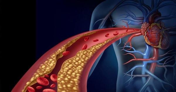 Mỗi ngày ăn 1 ít hành tây, đây chính là chìa khóa thanh lọc máu, còn ngăn chặn cả ‘tá’ bệnh - 1