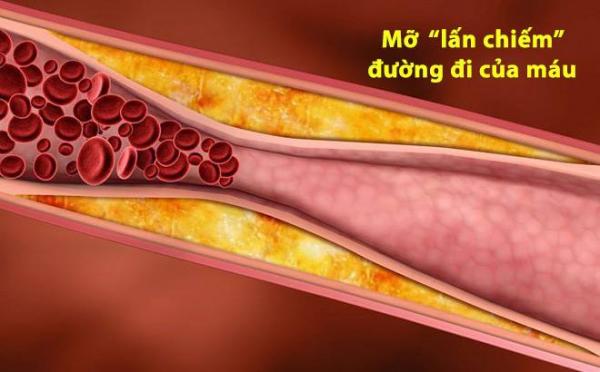 ‘Công thức vàng’ làm sạch mạch máu, giảm mỡ máu: Bài thuốc nên có trong mọi gia đình - 1