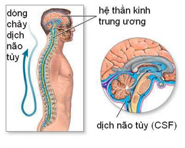 Nghiên cứu chấn động thế giới: Rối loạn giấc ngủ gây mất trí nhớ và Alzheimer - 3