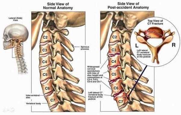 6 vị trí tử huyệt là nguồn gốc của sinh mệnh cần được chú ý bảo vệ - 3