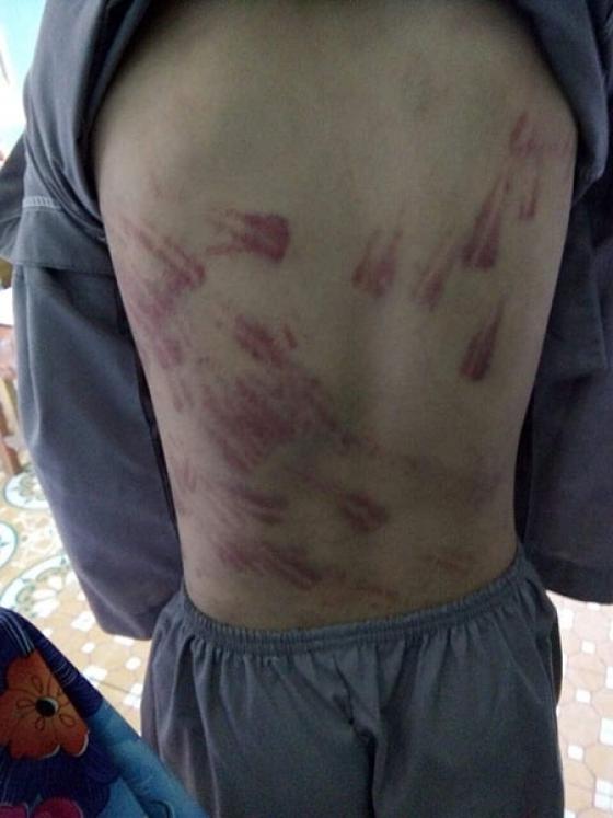 42 2 Viet Nam Be Trai Mo Coi Bi Su Thay Danh Bam Tim Khap Co The