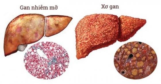 42 1 Thoi Quen Xau Nhieu Nguoi Dang Buc Tu La Gan Cua Minh