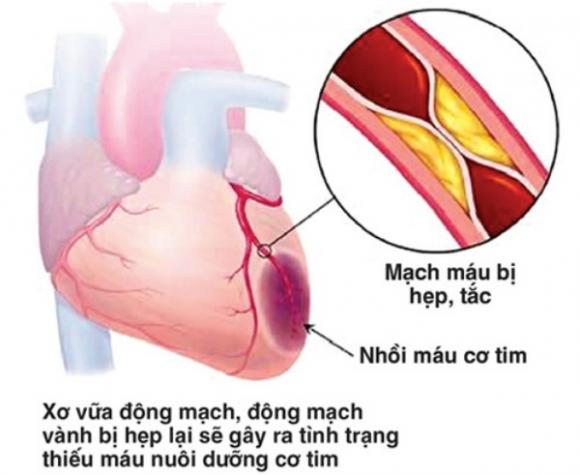 42 2 4 Mon An Quy Hon Thuoc Danh Cho Nguoi Bi Tang Huyet Ap Va Benh Mach Vanh