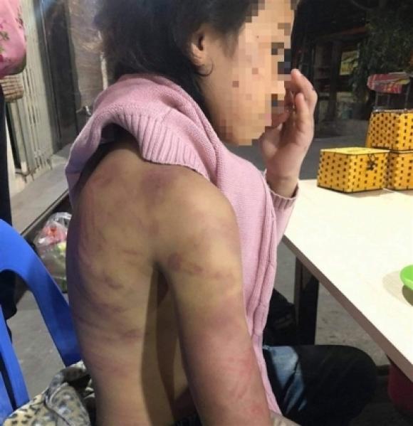 42 1 Be Gai 12 Tuoi Nghi Bi Bao Hanh Xam Hai Tinh Duc Cuc Tre Em Len Tieng