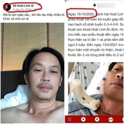 5 Lo Clip Ns Hoai Linh An Uong Duoc Cho La Vao Dung Ngay Mo Tuyen Giap Khien Du Luan Phan No