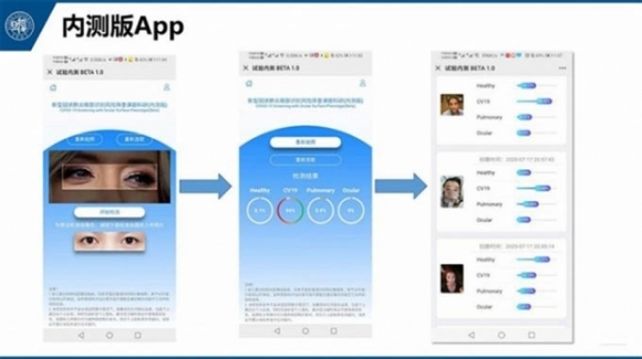 1 Trung Quoc Phat Trien Cong Nghe Phat Hien Nguy Co Mac Covid 19 Qua Kiem Tra Mat