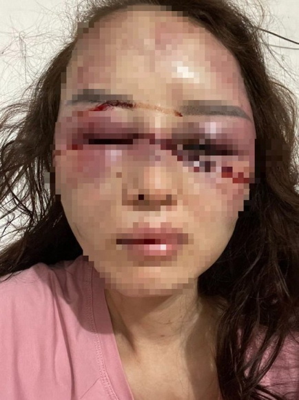 2 Cong An Vao Cuoc Vu Can Bo Qltt Danh Ban Gai Da Man Vi Hat Song Ca Voi Nguoi Khac