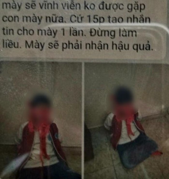 3 Vu Bo Bat Coc Con Gai Tai Thai Binh Dan Dung Canh Ly Ky Nhu Trong Phim