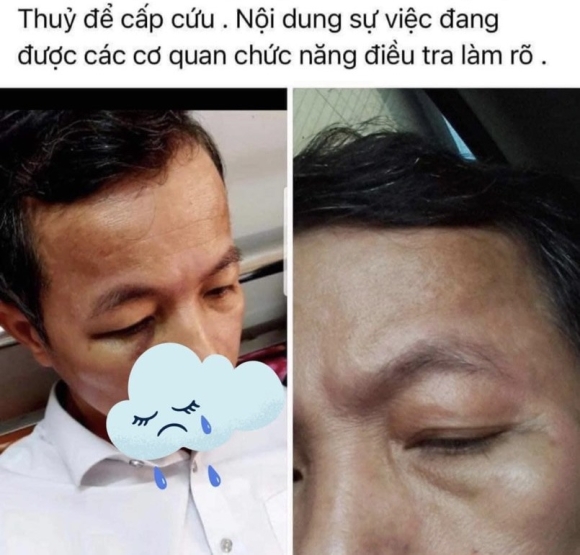 1 Quang Binh Cai Nhau Hieu Truong Danh Hieu Pho Vao Benh Vien