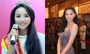 Thẩm mỹ viện chứng minh Hoa hậu Kỳ Duyên nói dối