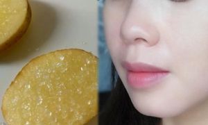 Chà lát khoai tây lên mặt 5 phút, 3 lần/tuần, tàn nhang, vết thâm mờ...