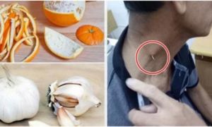 Cách chữa hóc xương cá vô cùng đơn giản lại rất hiệu quả mà ai cũng nên biết