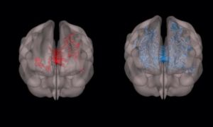 Sự khác biệt về ảnh quét não bộ của một đứa trẻ ham đọc sách và một đứa trẻ...