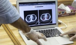 Iran công bố hệ thống chẩn đoán COVID-19 dựa trên công nghệ AI