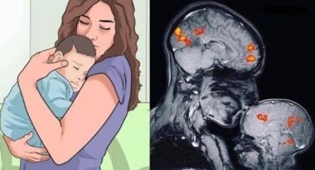 Ảnh chụp MRI cho thấy: Trẻ được vỗ về, ôm ấp từ nhỏ sẽ có nền tảng hạnh phúc...
