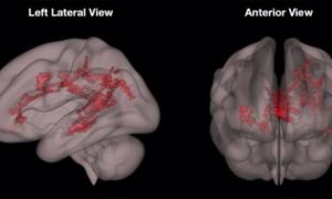 Hình ảnh khác biệt giữa não bộ của trẻ đọc sách và trẻ xem điện thoại