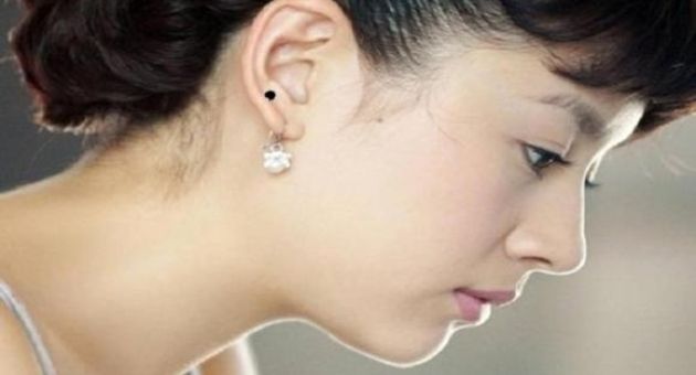 5 nốt ruồi bạc tỉ giàu nứt đố đổ vách chị em đừng vội xóa đi