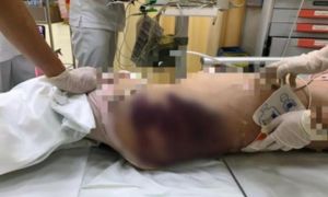 UNICEF bày tỏ đau buồn về vụ 'dì ghẻ' đánh bé gái 8 tuổi tử vong