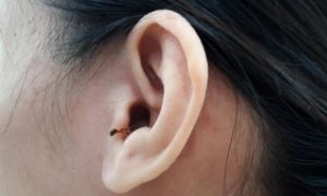 Đang ngủ thì bọ chui vào tai, bạn sẽ làm gì? Bác sĩ lời khuyên 1 việc tuyệt...