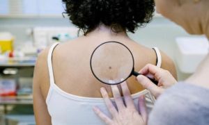 Những dấu hiệu cảnh báo ung thư sớm, bác sĩ hướng dẫn cách tự kiểm tra tại nhà