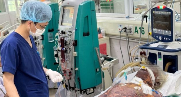 Không ăn thịt chua, tiết canh, người đàn ông vẫn nguy kịch vì nhiễm liên cầu lợn