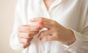 Stress làm tăng nguy cơ mắc bệnh gout thế nào