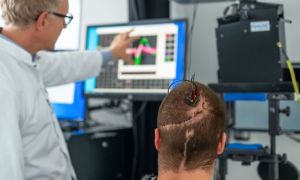 Lần đầu tiên tại châu Âu: Bệnh viện Đại học Kỹ thuật Munich đã cấy ghép giao...